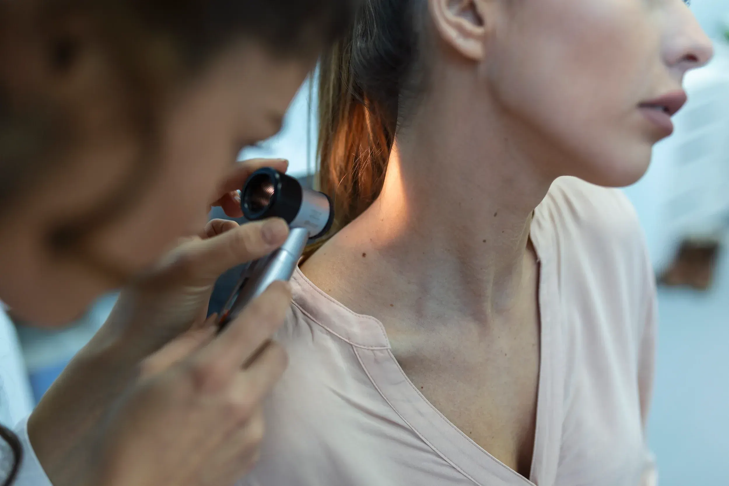 Common Areas We Remove Skin Tags