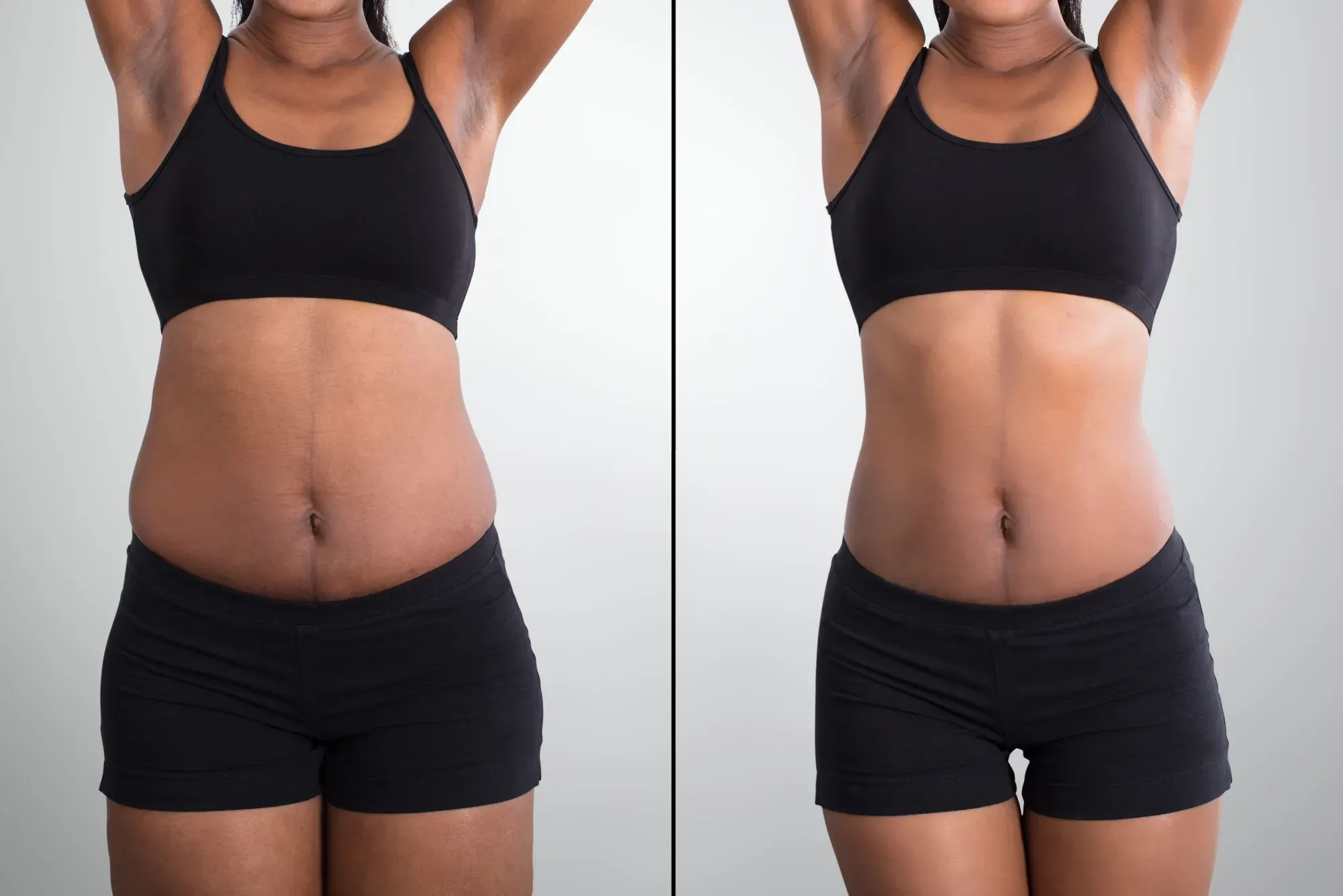 GLP-1 Weight Loss in Venice, FL before and after